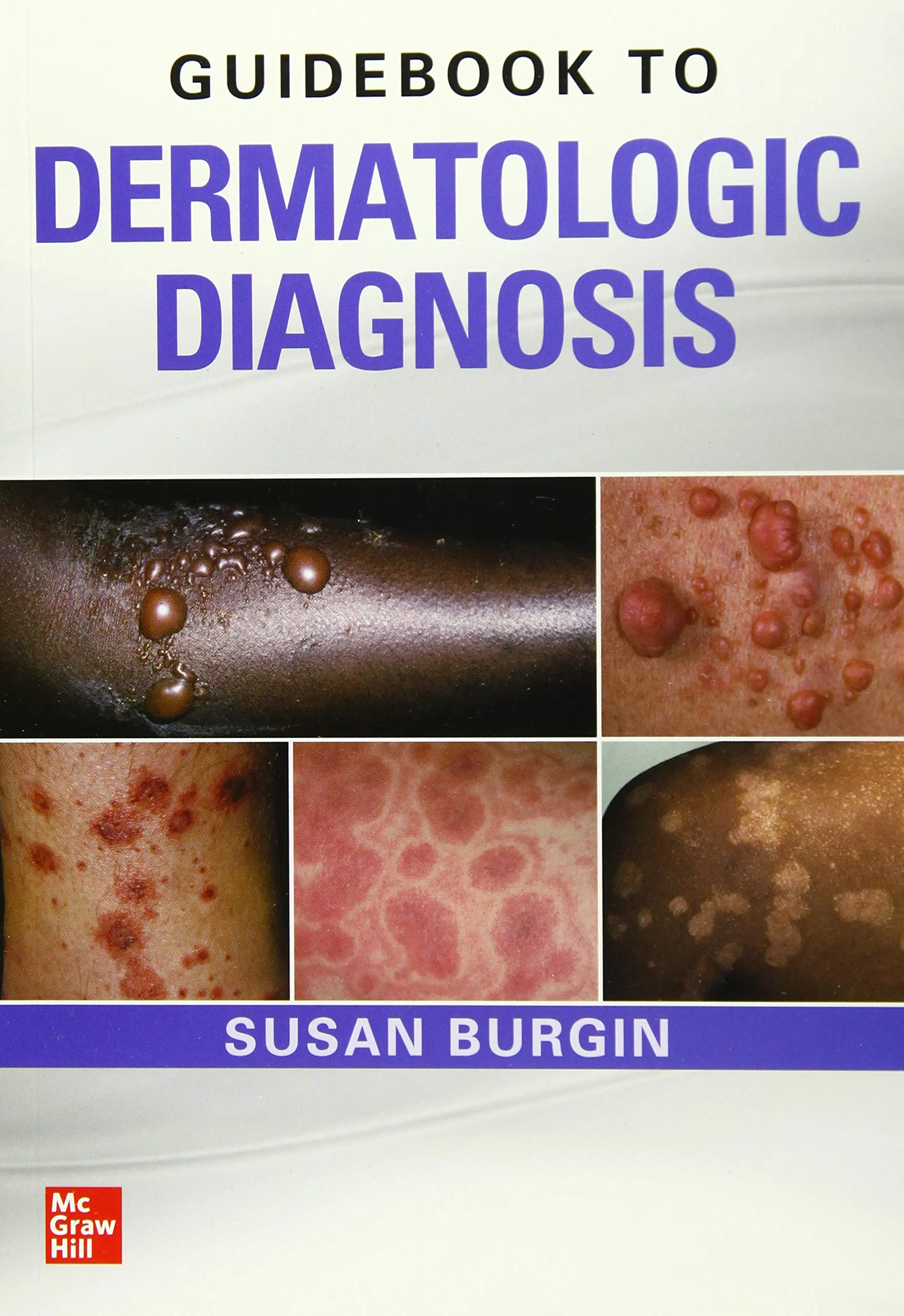 Coperta cărții "Guidebook to Dermatologic Diagnosis" de Susan Burgin