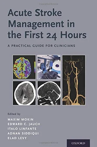 Coperta cărții "Acute Stroke Management in the First 24 Hours: A Practical Guide for Clinicians " de Adnan Siddiqui, Elad Levy, Maxim Mokin, Edward C. Jauch, Italo Linfante