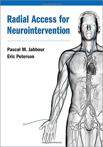 Coperta cărții "Radial Access for Neurointervention" de Pascal Jabbour, Eric Peterson