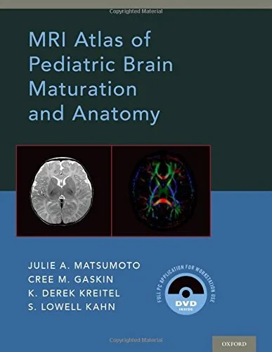 MRI Atlas of Pediatric Brain Maturation and Anatom...