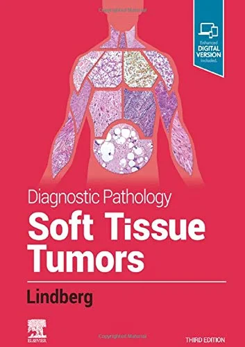Diagnostic Pathology: Soft Tissue Tumors