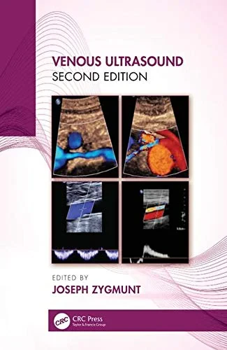 Coperta cărții "Venous Ultrasound" de Joseph A. Zygmunt Jr.