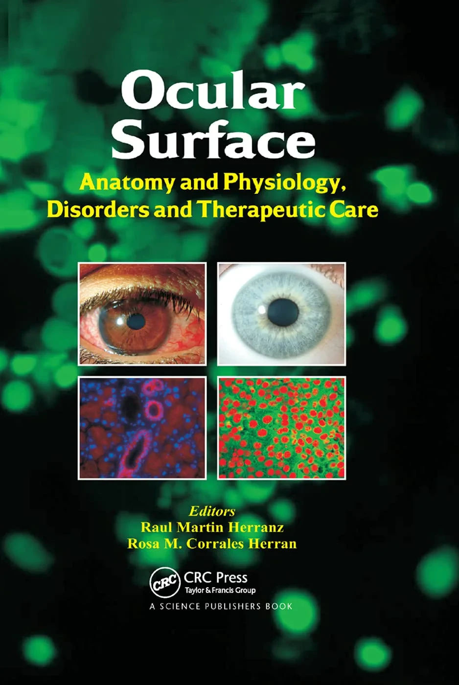 Coperta cărții "Ocular Surface: Anatomy and Physiology, Disorders and Therapeutic Care" de Raul Martin Herranz, Rosa M. Corrales Herran