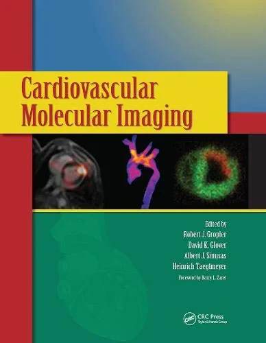 Coperta cărții "Cardiovascular Molecular Imaging " de Robert J. Gropler, David K. Glover, Albert J. Sinusas