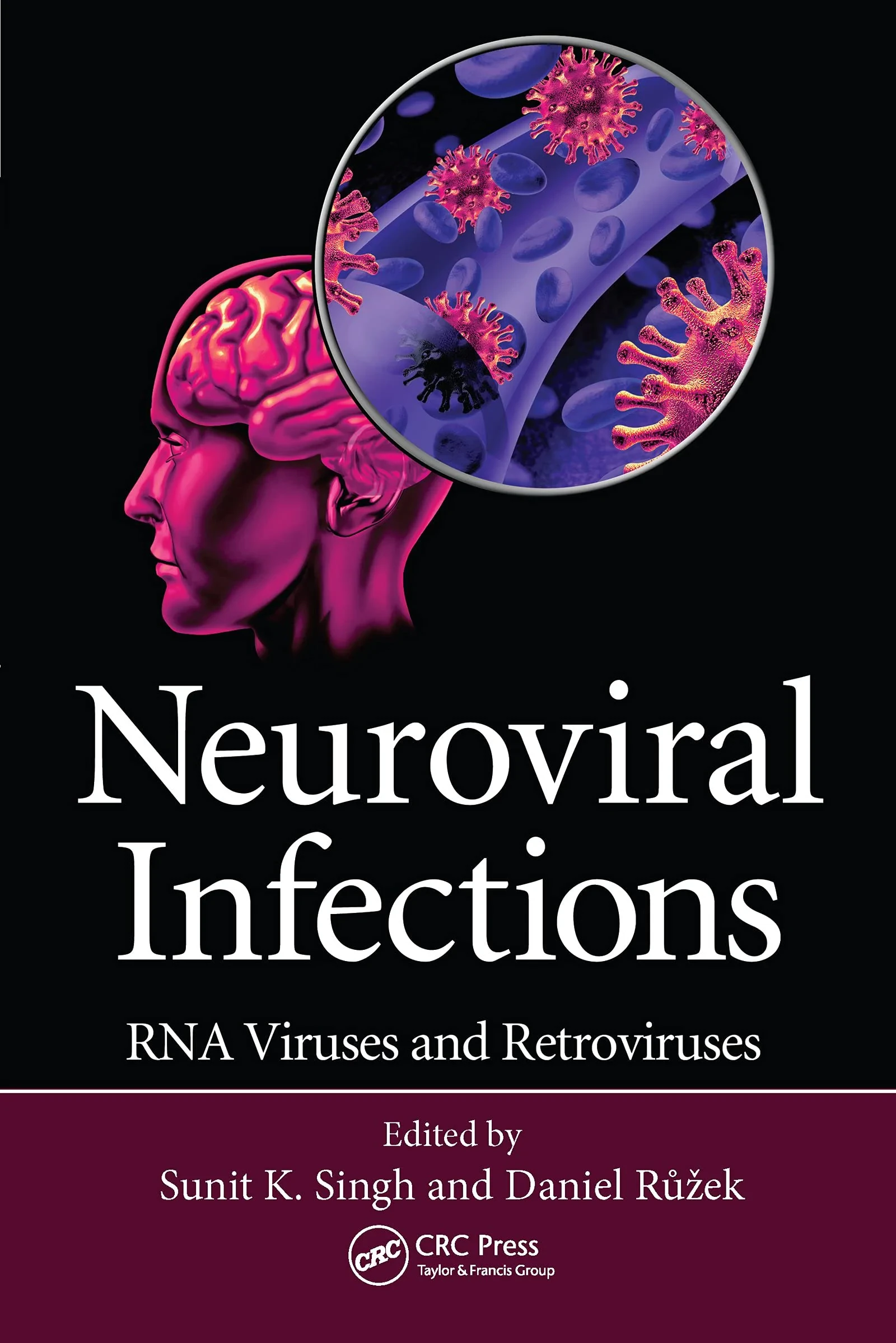 Coperta cărții "Neuroviral Infections: RNA Viruses and Retroviruses" de Sunit K. Singh, Daniel Ruzek