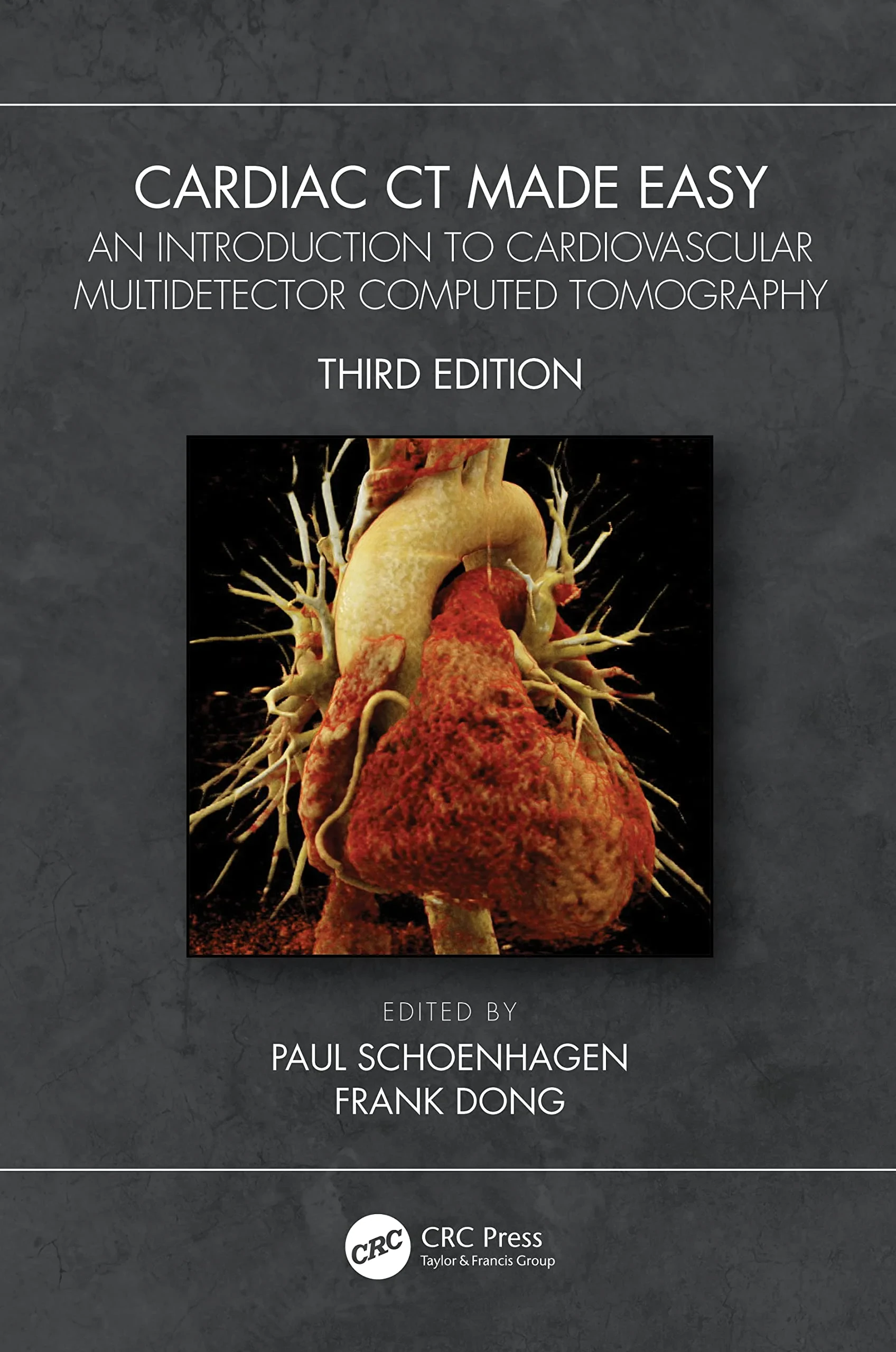 Coperta cărții "Cardiac CT Made Easy" de Paul Schoenhagen