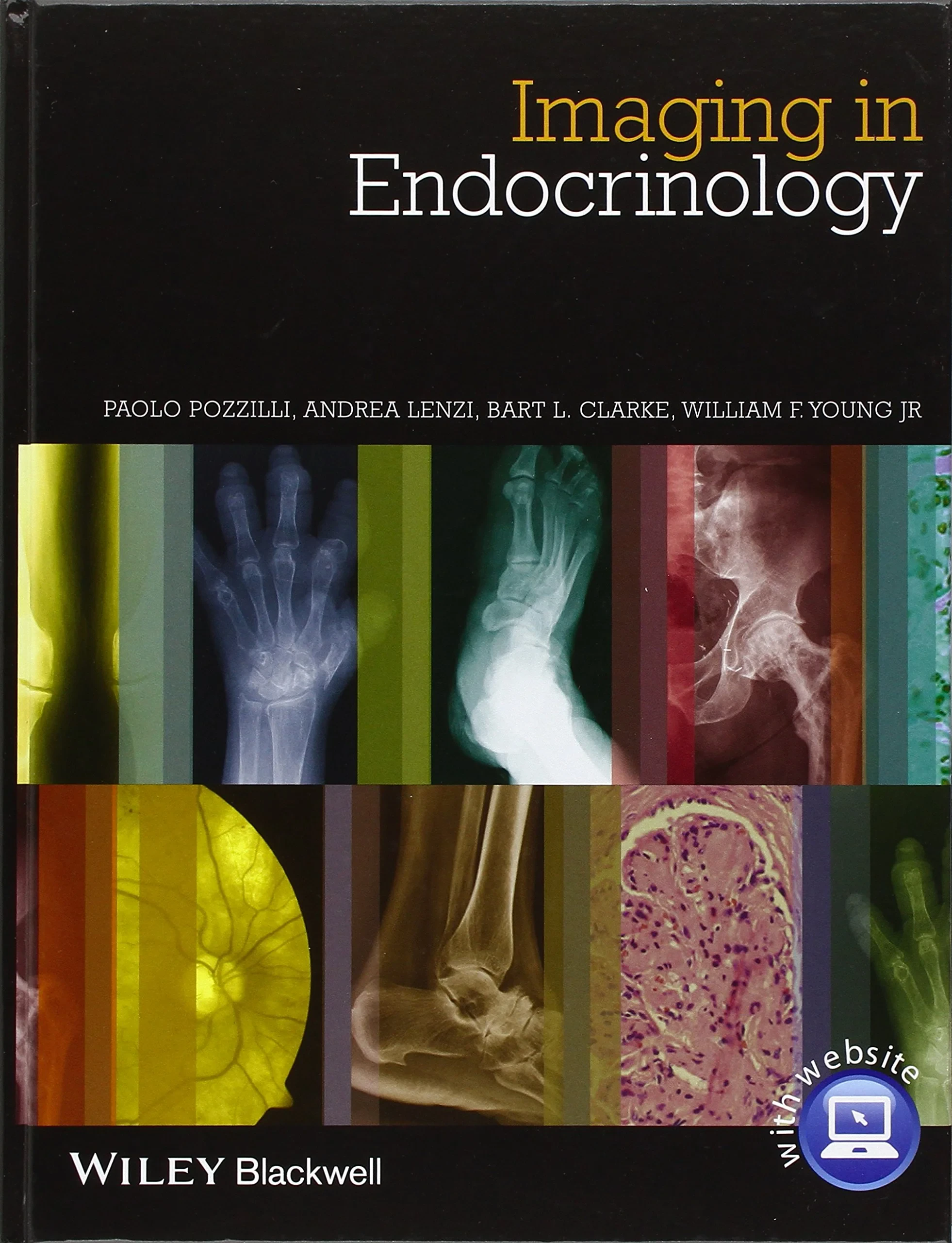 Coperta cărții "Imaging in Endocrinology" de Paolo Pozzilli, Andrea Lenzi