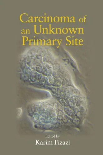 Coperta cărții "Carcinoma of an Unknown Primary Site" de Karim Fizazi