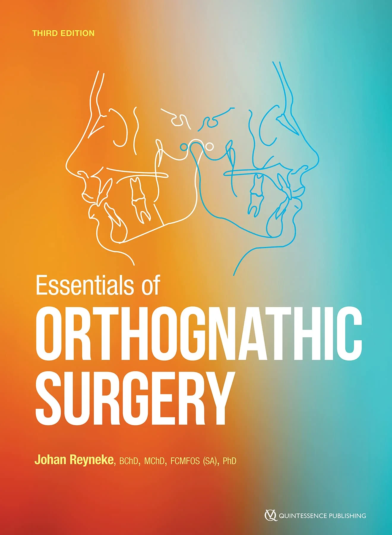 Coperta cărții "Essentials of Orthognathic Surgery" de Reyneke, Johan