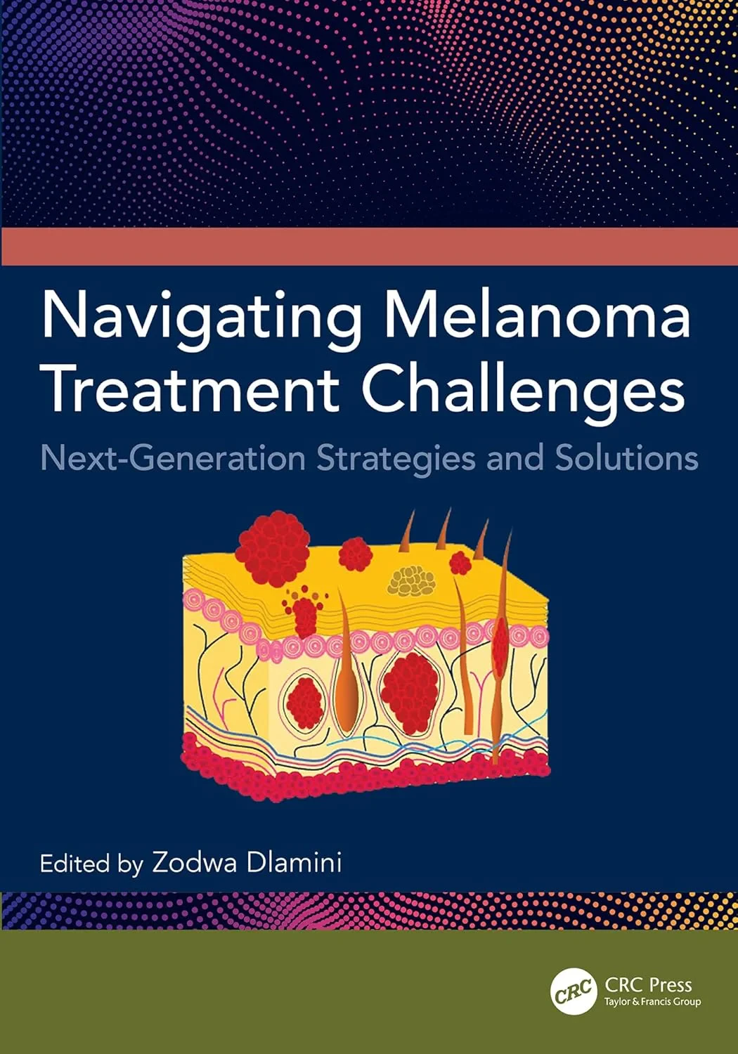 Coperta cărții "Navigating Melanoma Treatment Challenges. Next-Generation Strategies and Solutions" de Zodwa Dlamini