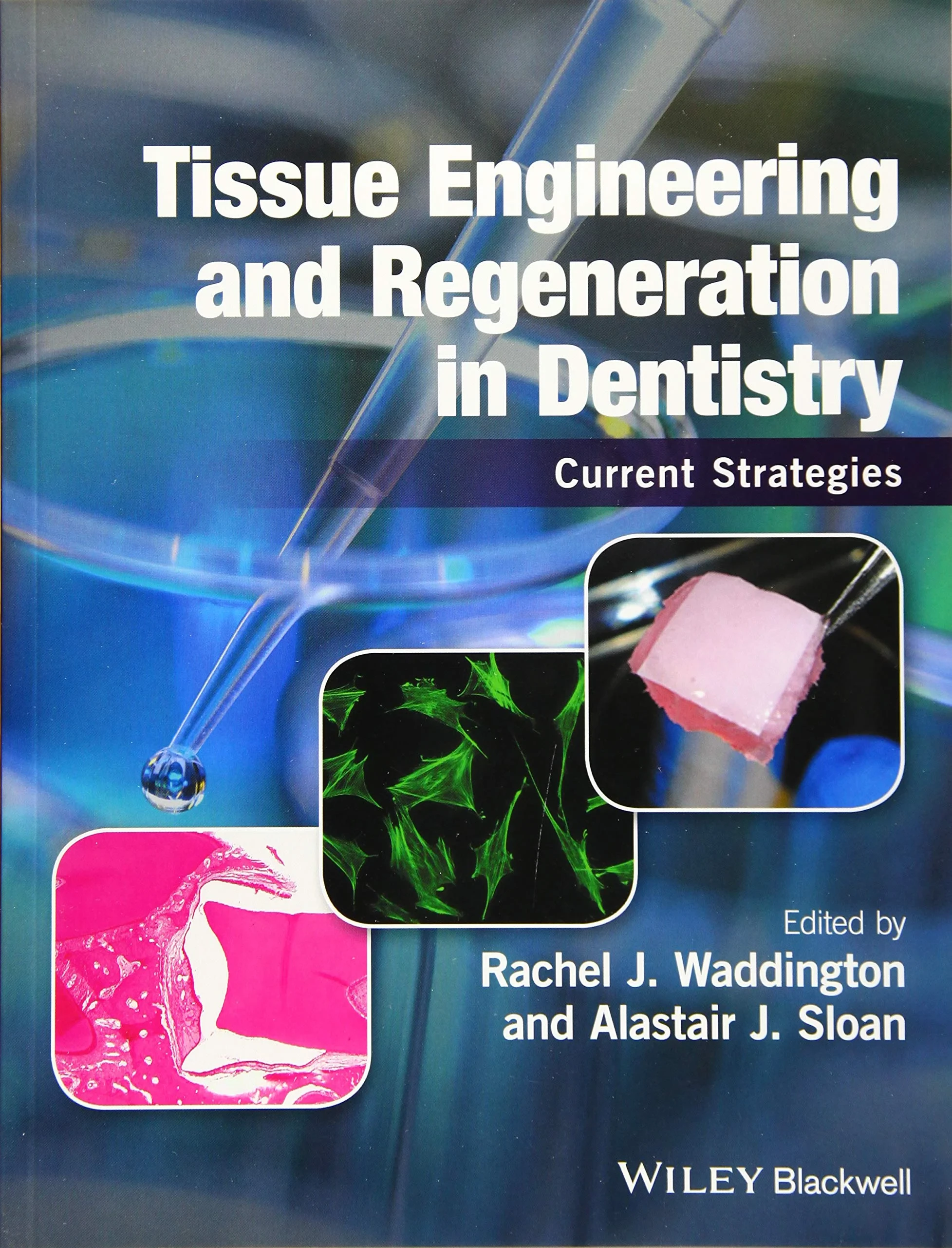 Coperta cărții "Tissue Engineering and Regeneration in Dentistry: Current Strategies" de Rachel J. Waddington, Alastair J. Sloan