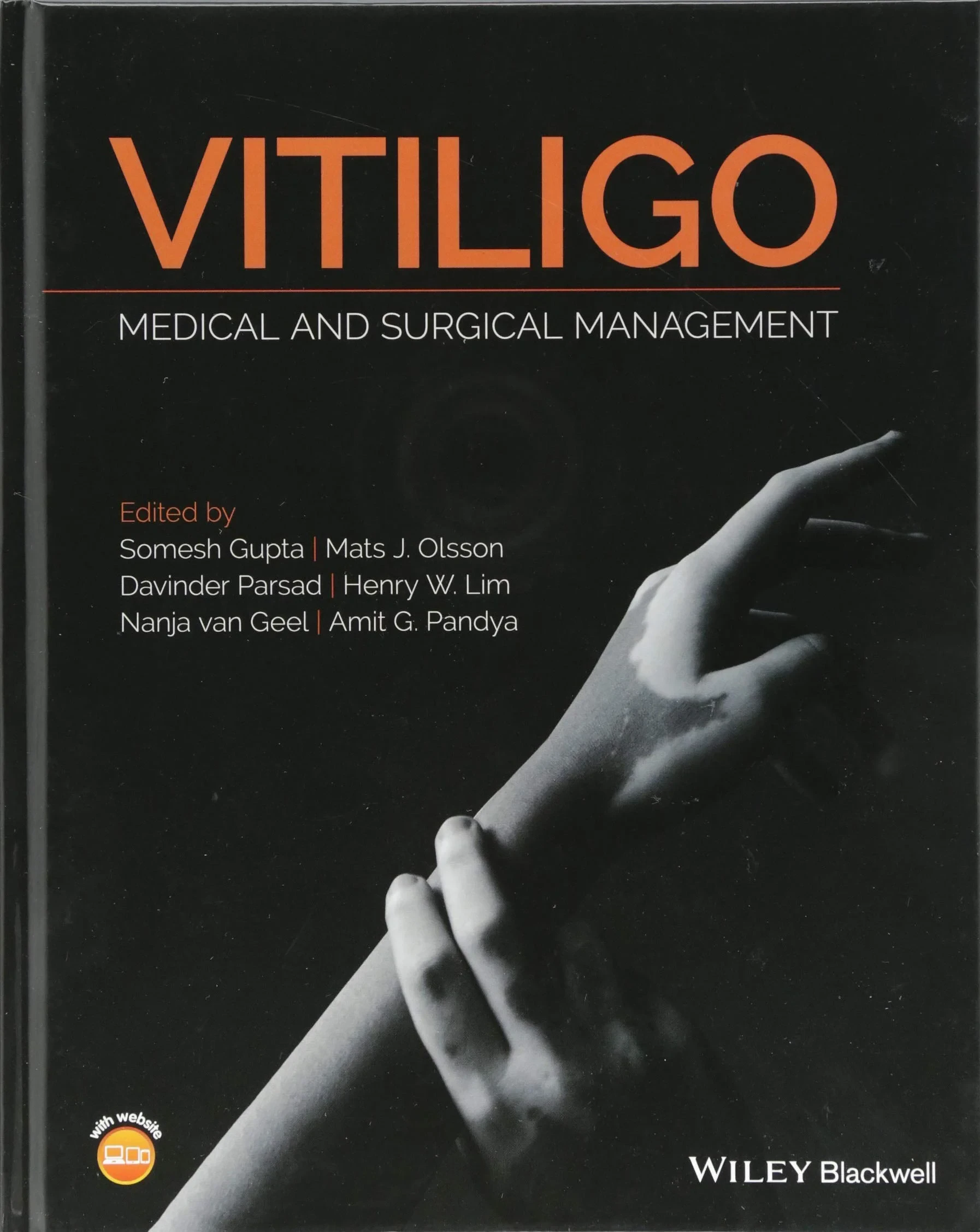 Vitiligo: Medical and Surgical Management