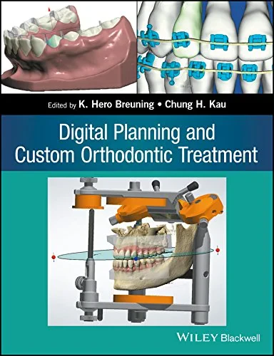 Coperta cărții "Digital Planning and Custom Orthodontic Treatment " de Chung H. Kau, K. Hero Breuning