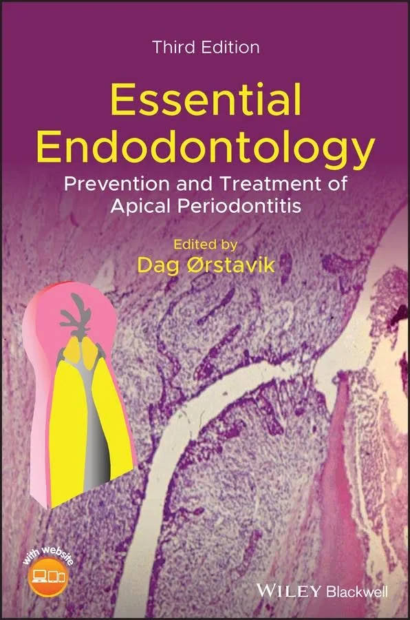 Coperta cărții "Essential Endodontology: Prevention and Treatment of Apical Periodontitis" de Dag Orstavik