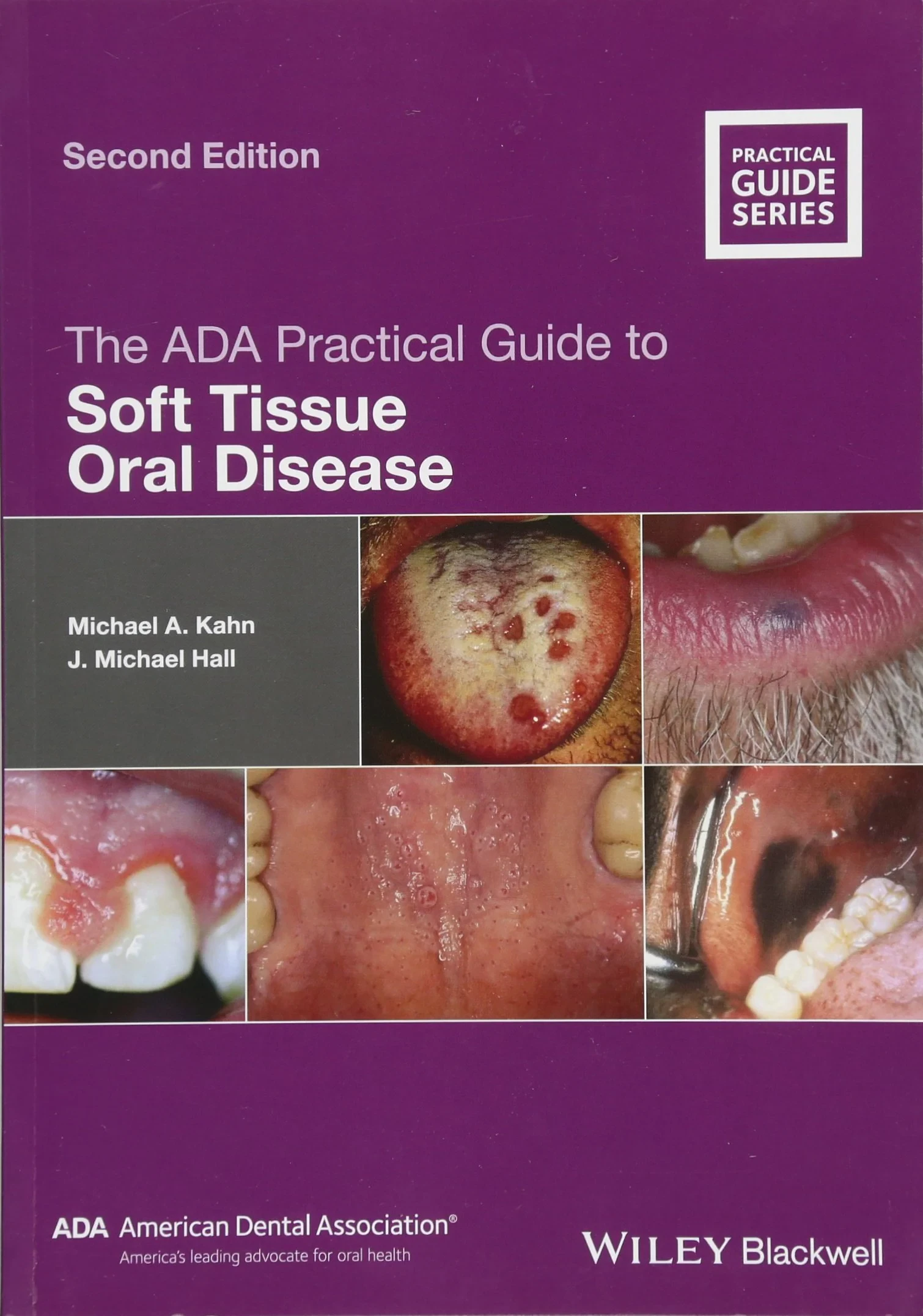 Coperta cărții "The ADA Practical Guide to Soft Tissue Oral Disease" de Kahn