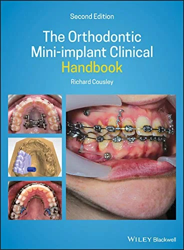 Coperta cărții "The Orthodontic Mini–implant Clinical Handbook" de Richard Cousley