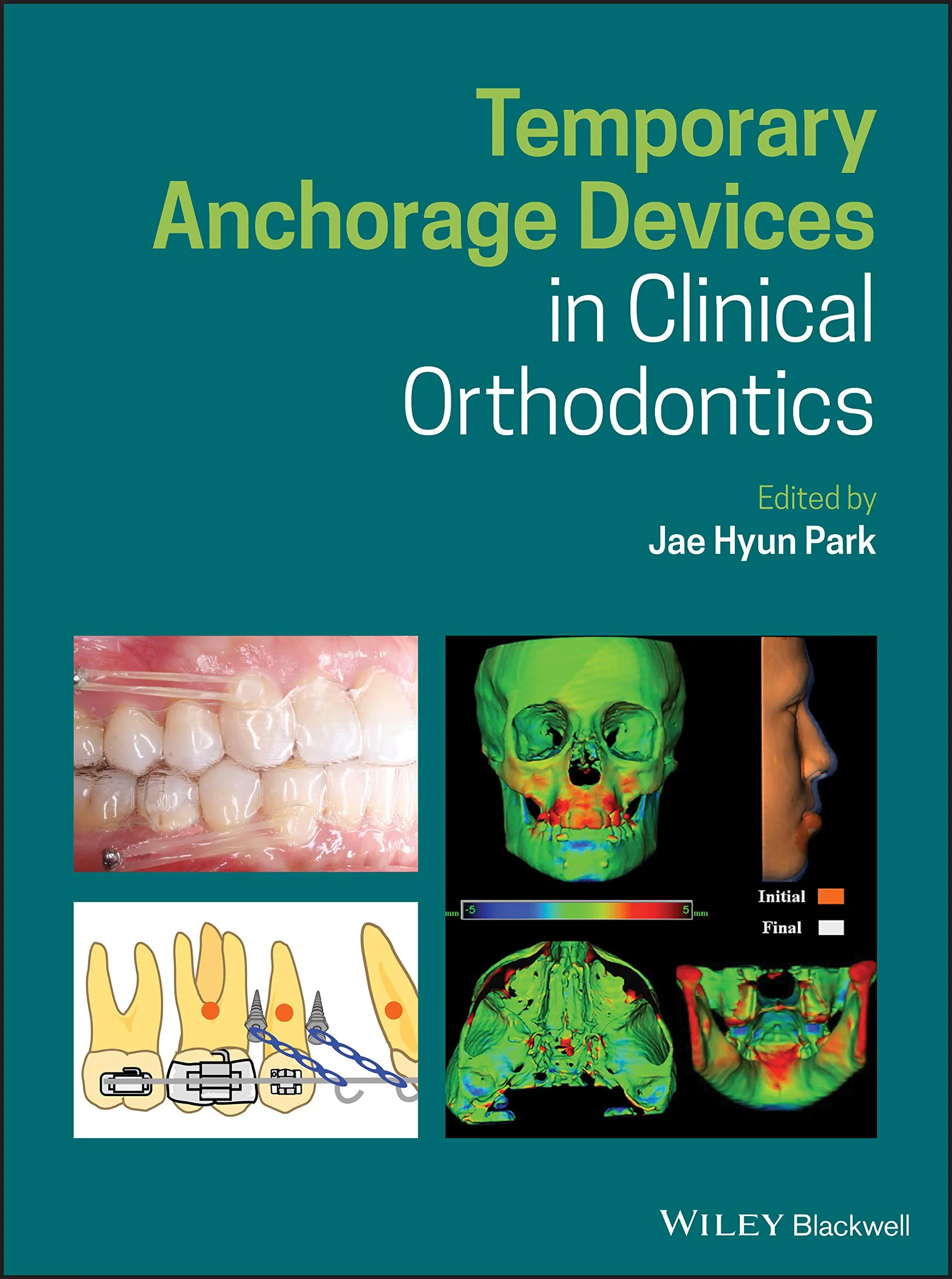 Temporary Anchorage Devices in Clinical Orthodonti...
