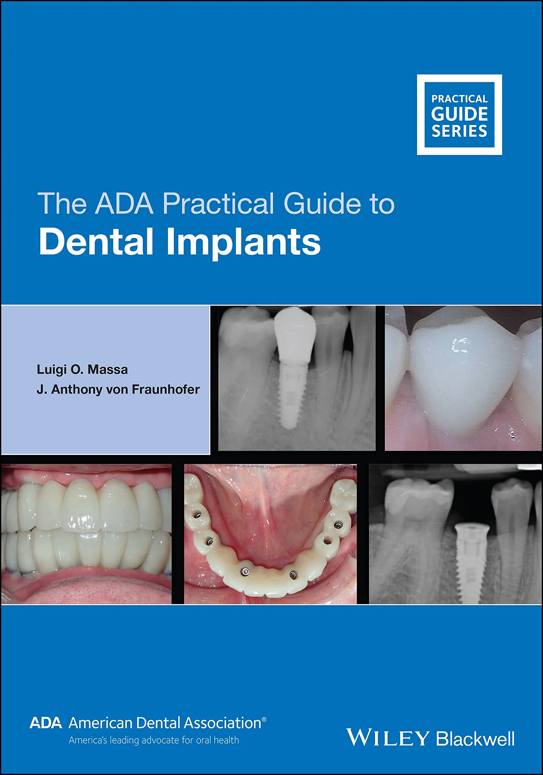 Coperta cărții "The ADA Practical Guide to Dental Implants" de Luigi O. Massa, J. Anthony von Fraunhofer