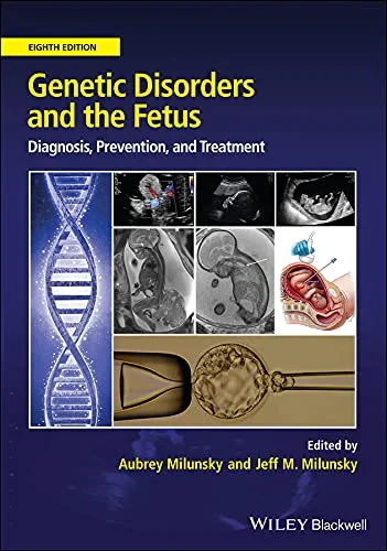 Genetic Disorders and the Fetus: Diagnosis, Preven...