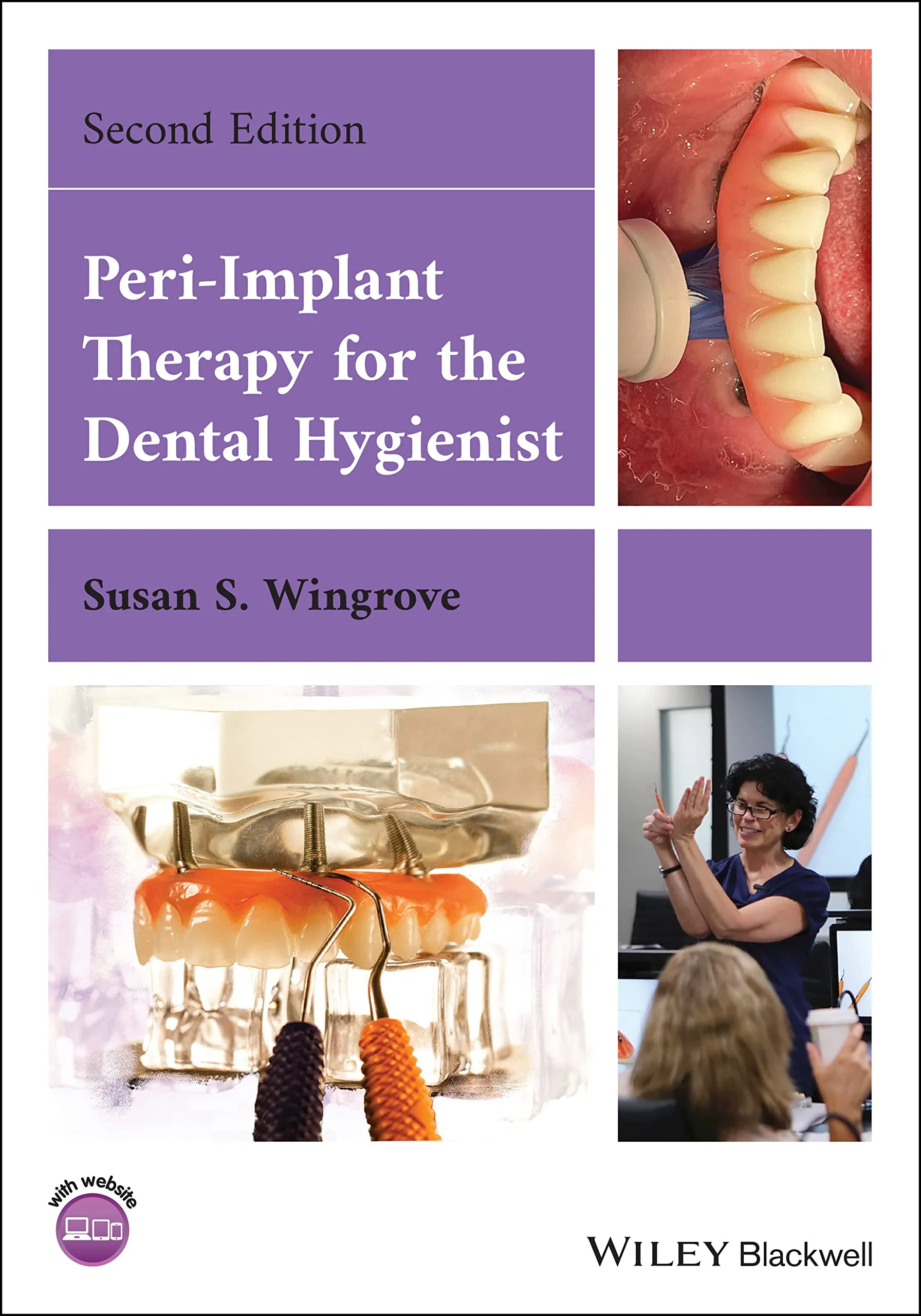 Coperta cărții "Peri–Implant Therapy for the Dental Hygienist" de S Wingrove