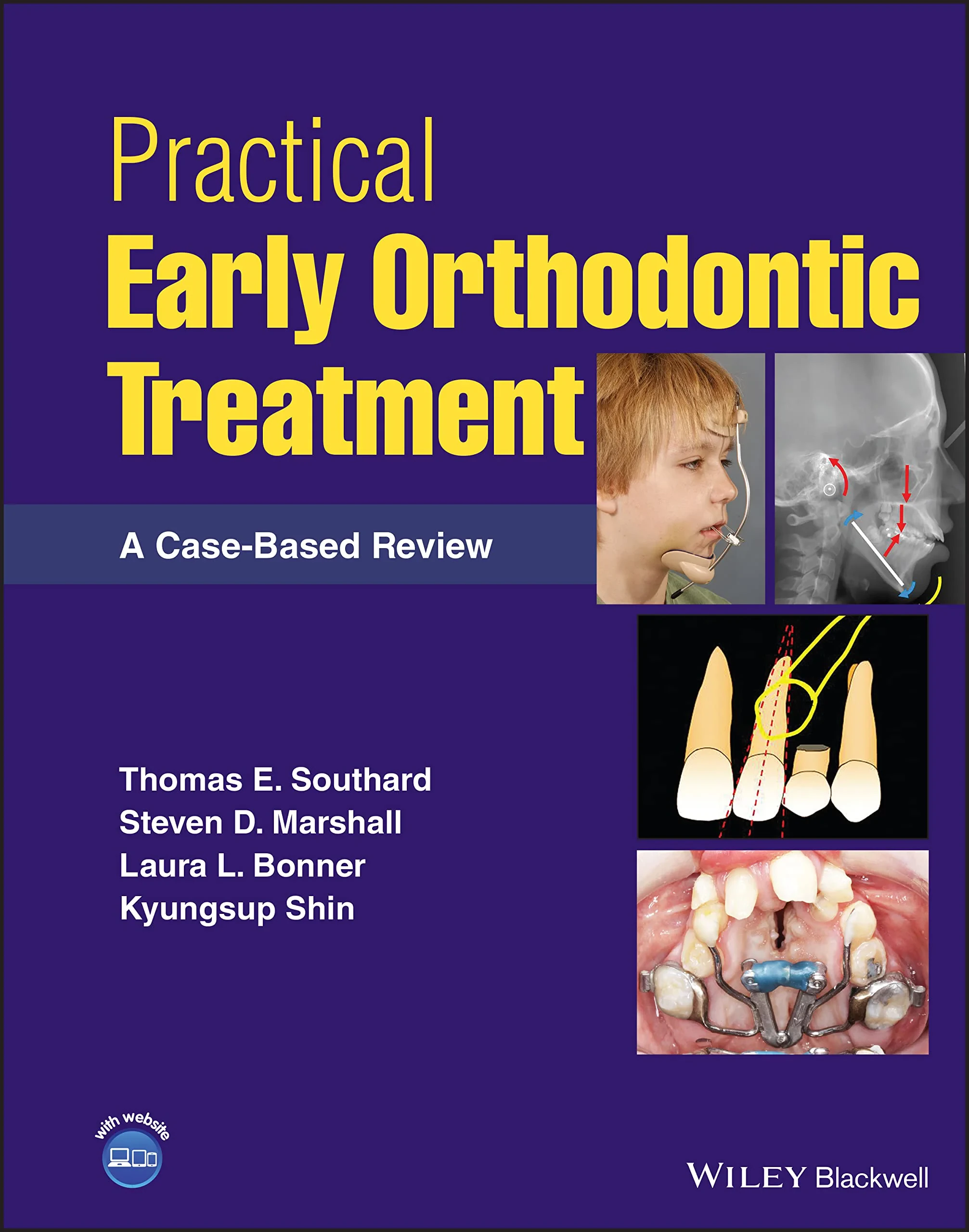 Practical Early Orthodontic Treatment: A Case-Base...