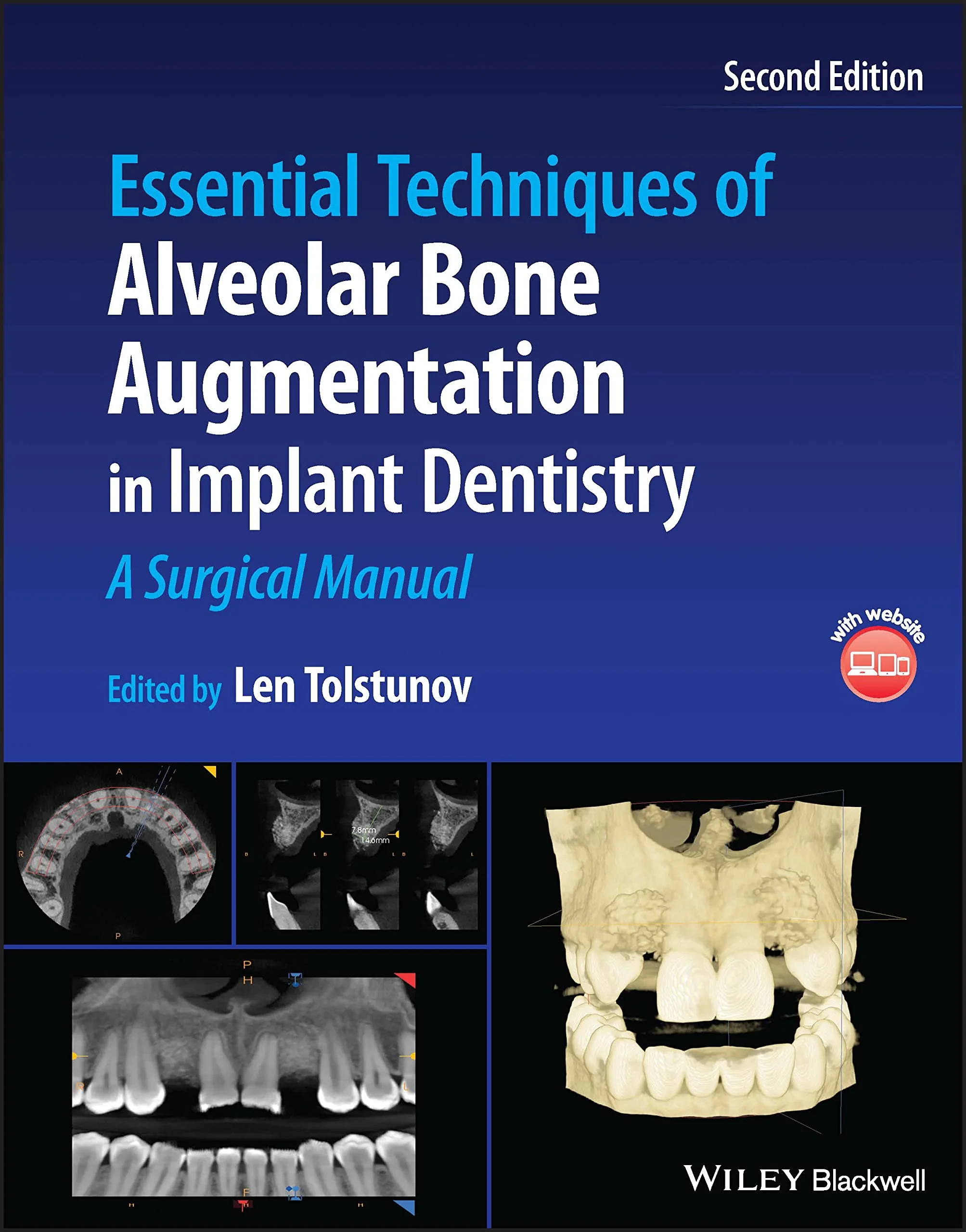 Essential Techniques of Alveolar Bone Augmentation...