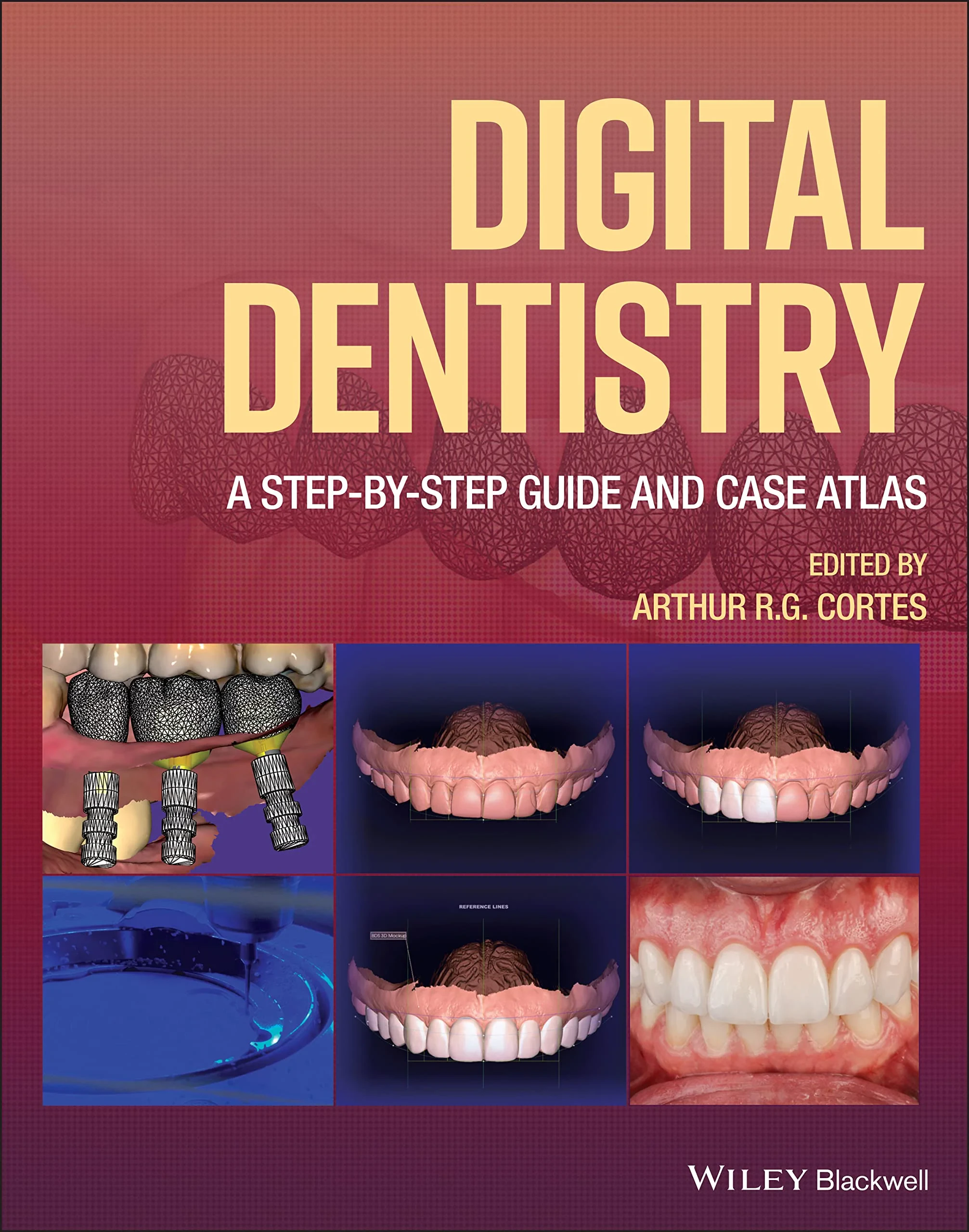 Coperta cărții "Digital Dentistry: A Step–by–Step Guide and Case Atlas " de Arthur R. Cortes