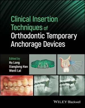 Coperta cărții "Clinical Insertion Techniques of Orthodontic Temporary Anchorage Devices" de H Long