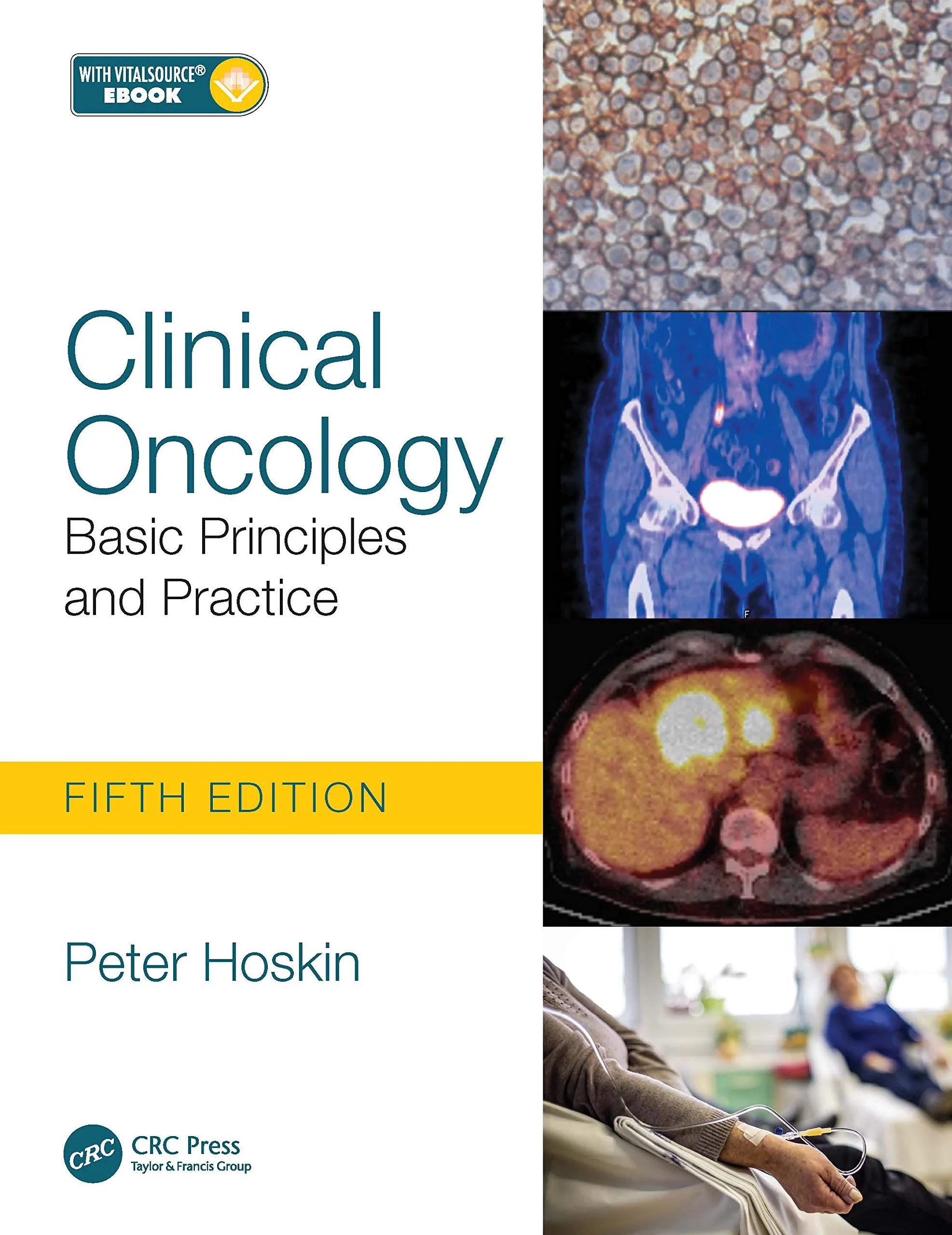 Coperta cărții "Clinical Oncology: Basic Principles and Practice " de Peter Hoskin
