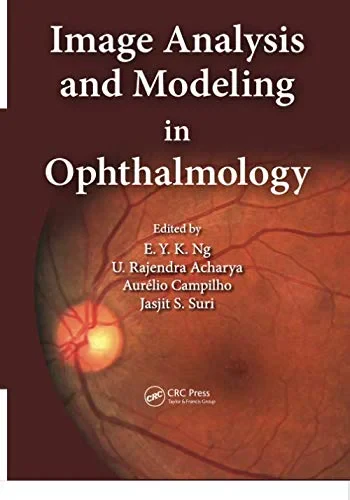 Coperta cărții "Image Analysis and Modeling in Ophthalmology" de Eddie Y. K. Ng