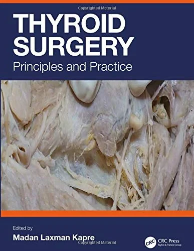 Coperta cărții "Thyroid Surgery" de Madan Laxman Kapre