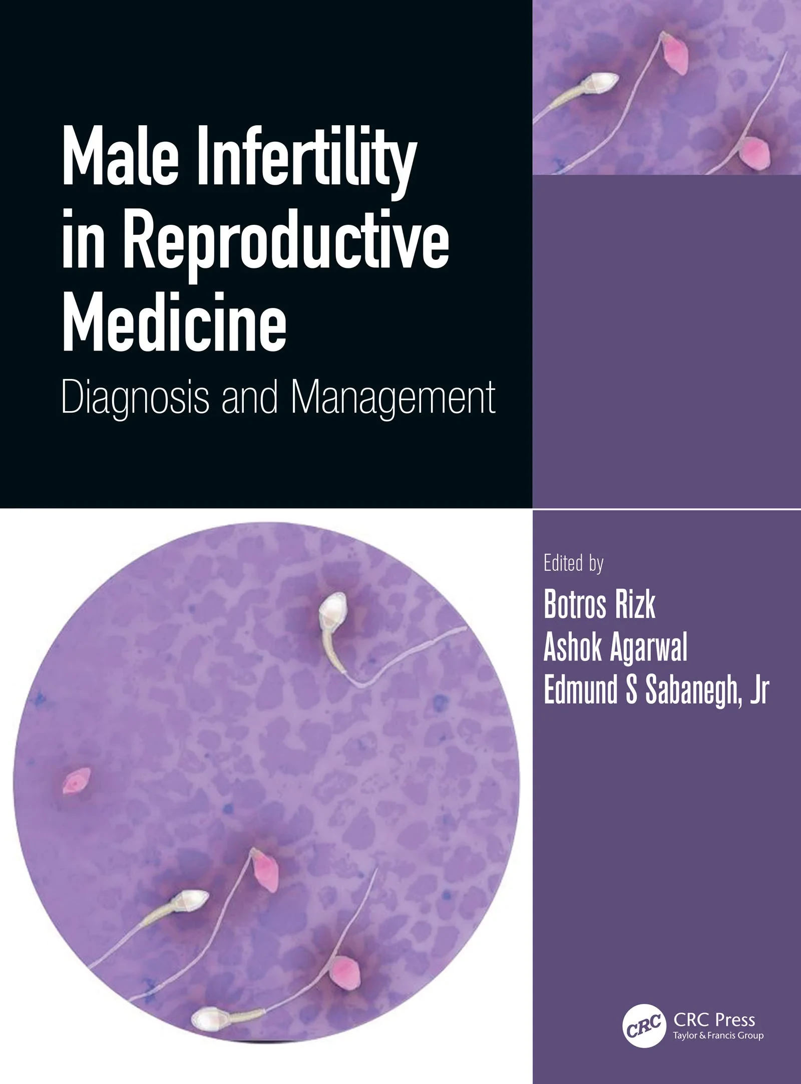 Male Infertility in Reproductive Medicine: Diagnos...