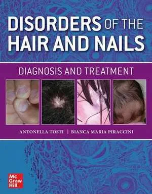 Disorders of the Hair and Nail: Diagnosis and Trea...