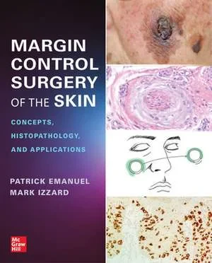 Coperta cărții "Margin Control Surgery of the Skin" de Patrick Emanuel, Mark Izzard