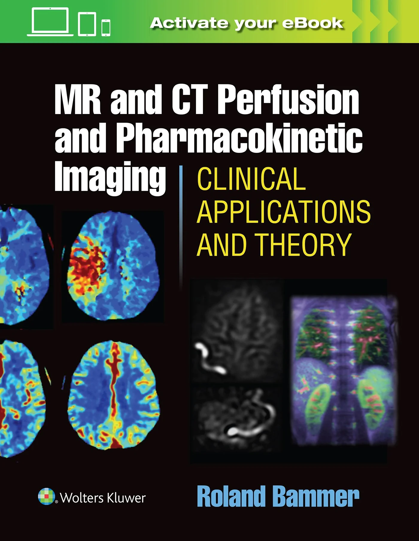 MR and CT Perfusion and Pharmacokinetic Imaging: C...