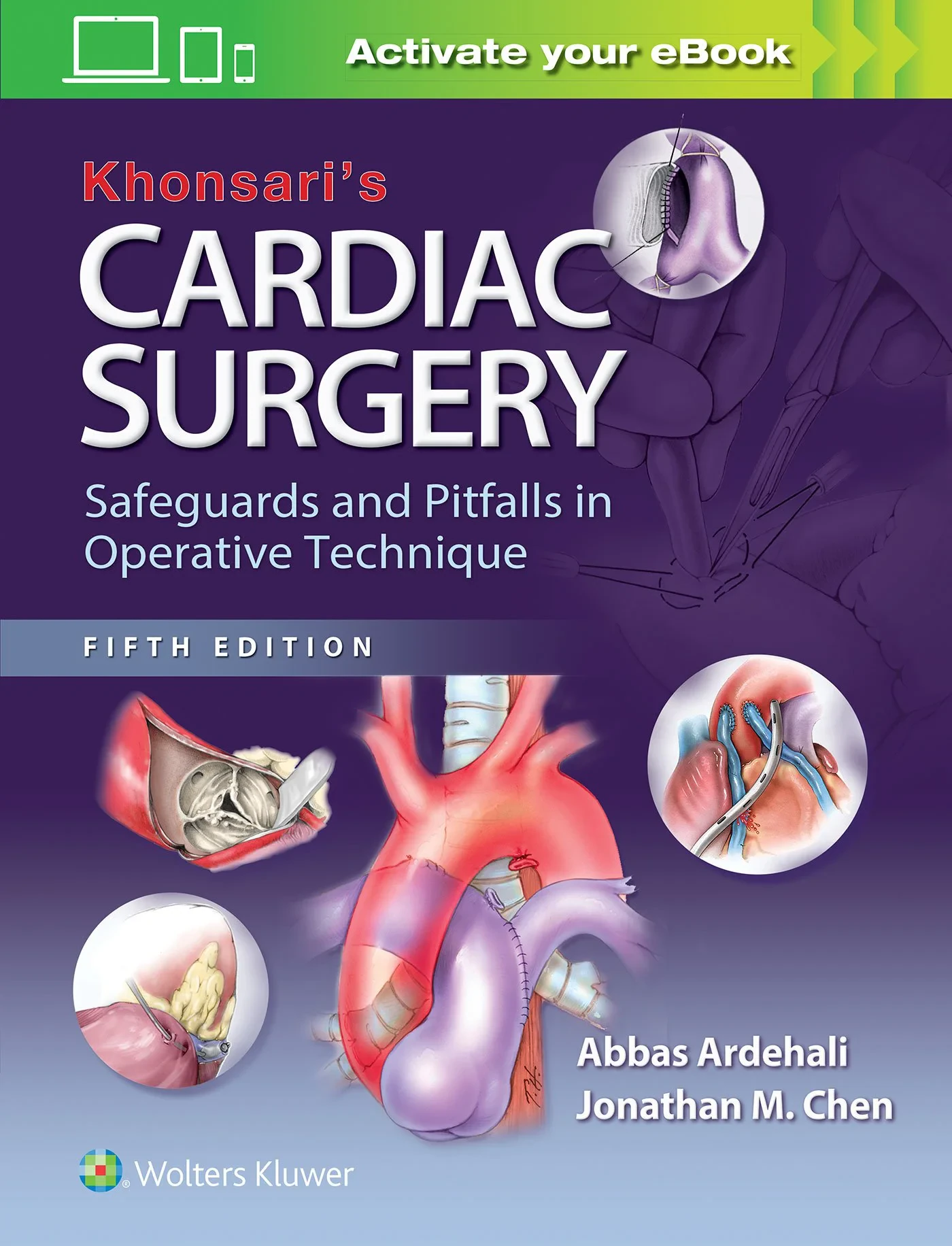 Khonsari’s Cardiac Surgery: Safeguards and Pitfall...