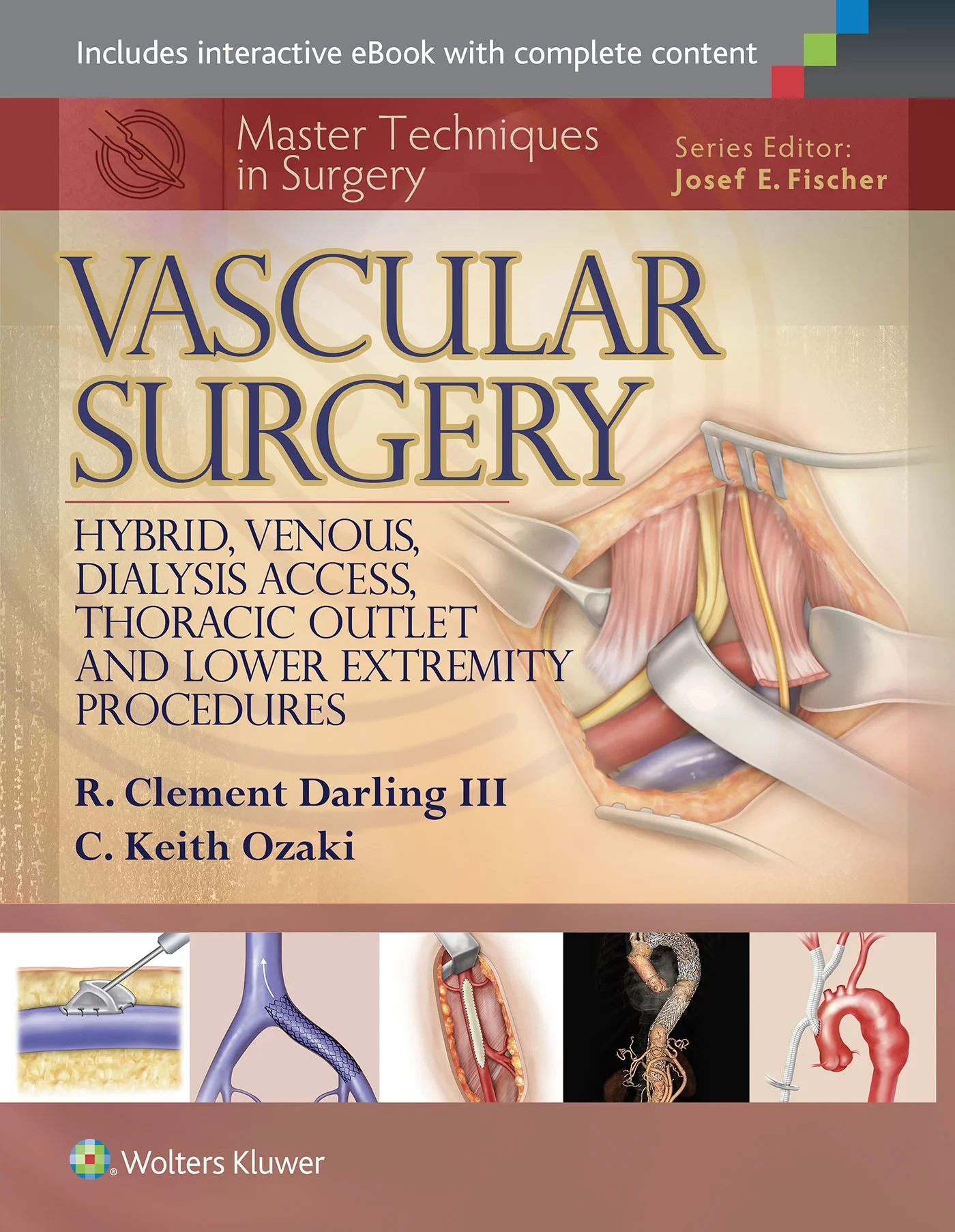 Master Techniques in Surgery: Vascular Surgery: Ar...