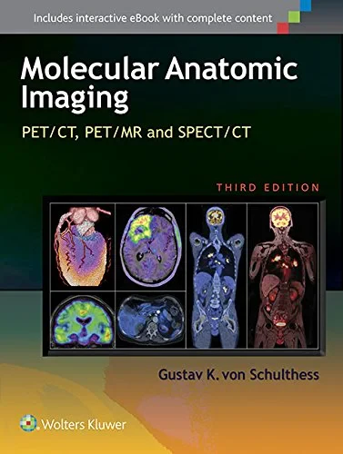 Molecular Anatomic Imaging: PET/CT, PET/MR and SPE...