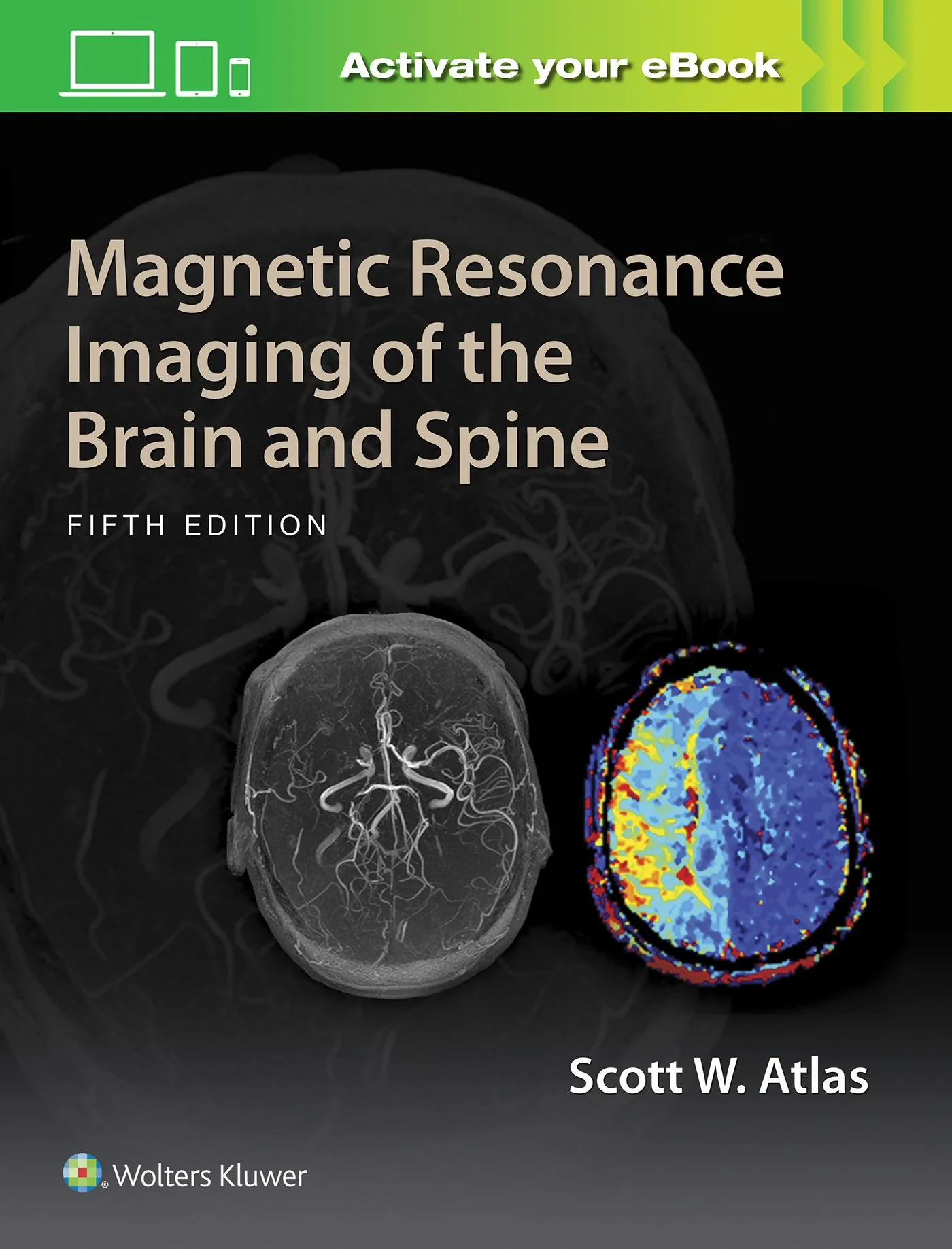 Magnetic Resonance Imaging of the Brain and Spine,...