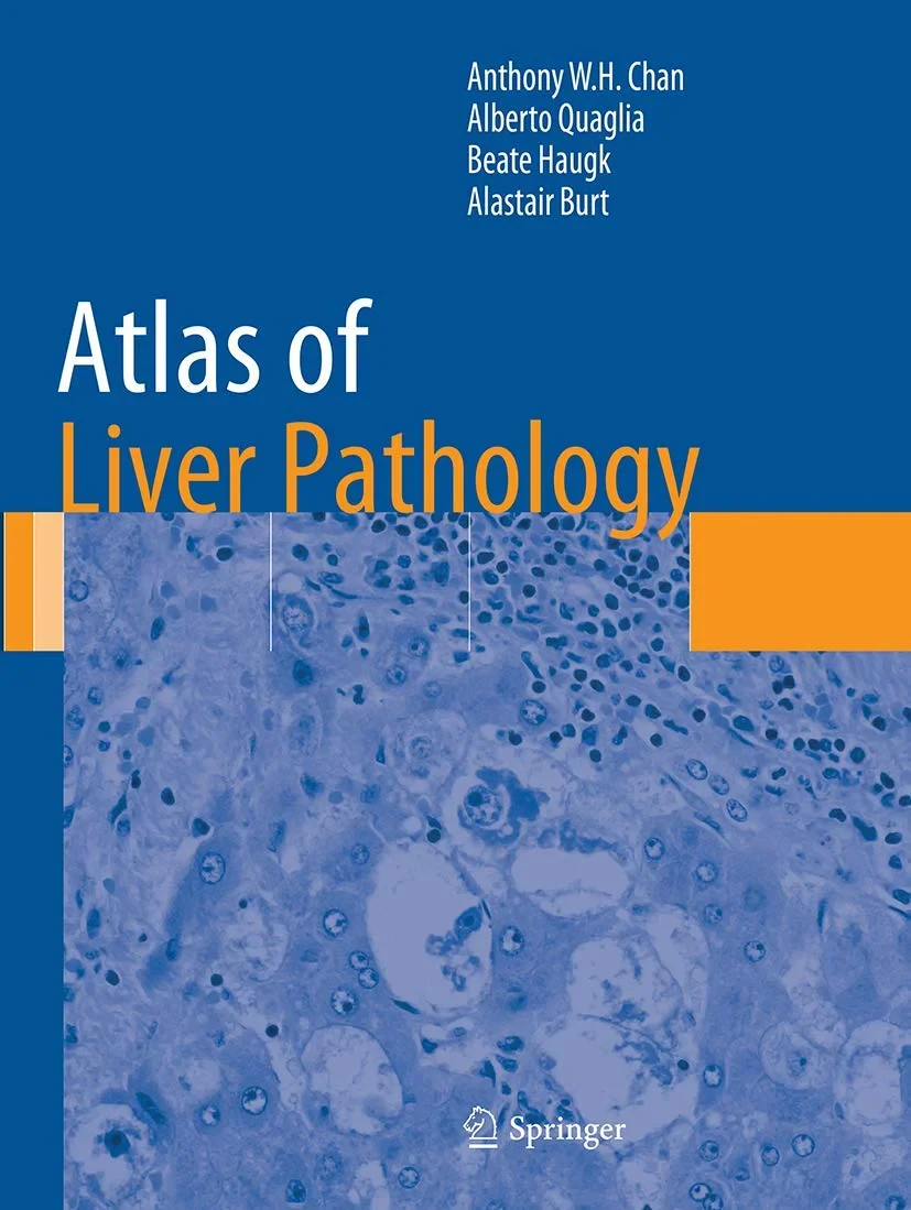 Coperta cărții "Atlas of Liver Pathology (Atlas of Anatomic Pathology) " de Anthony W.H. Wing Hung Chan, Alberto Quaglia, Beate Haugk