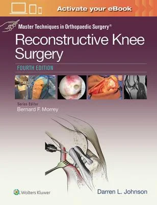 Master Techniques in Orthopaedic Surgery: Reconstr...