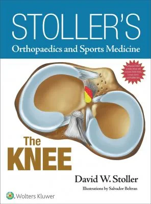Stoller’s Orthopaedics and Sports Medicine: The Kn...