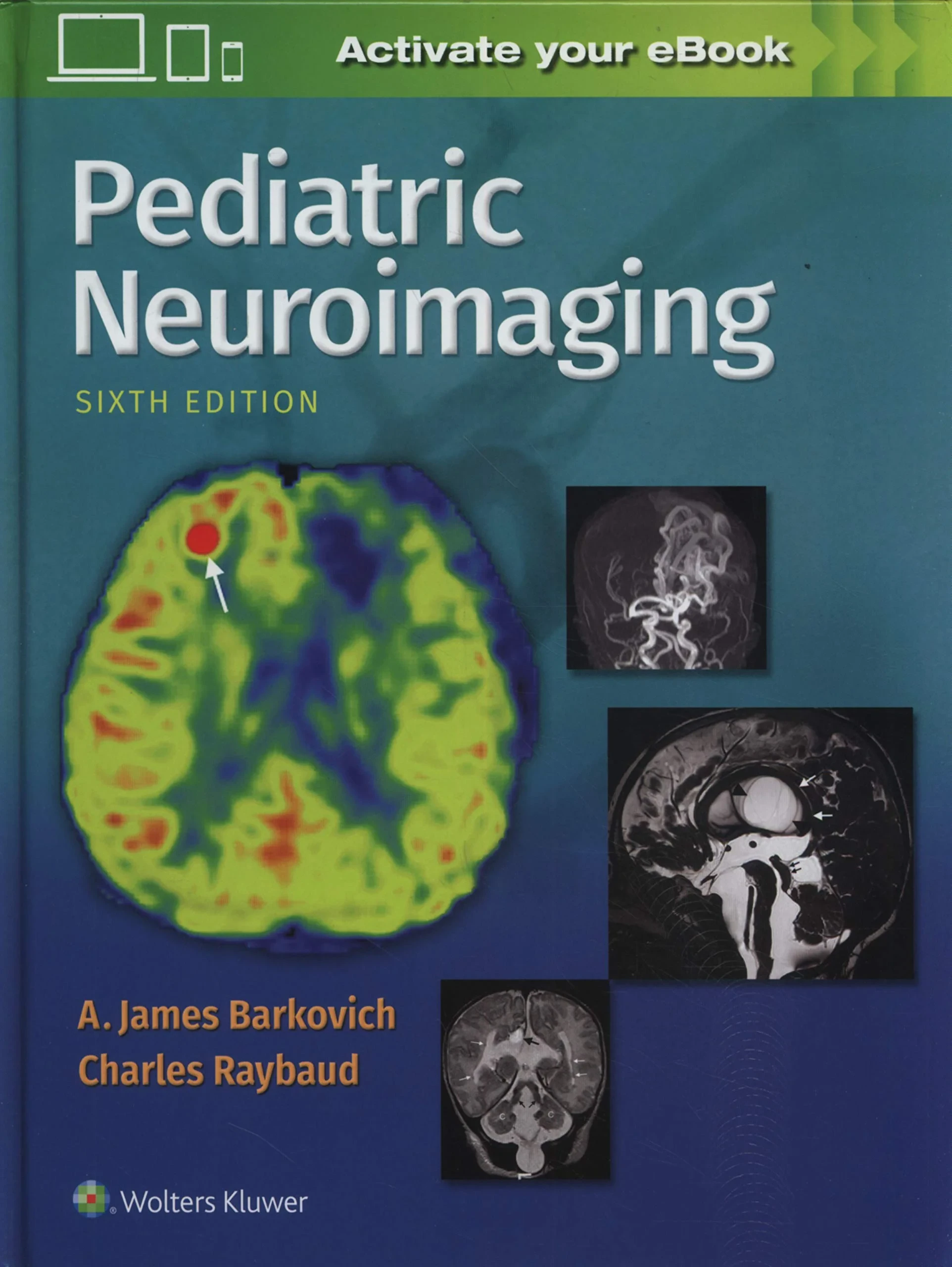 Pediatric Neuroimaging