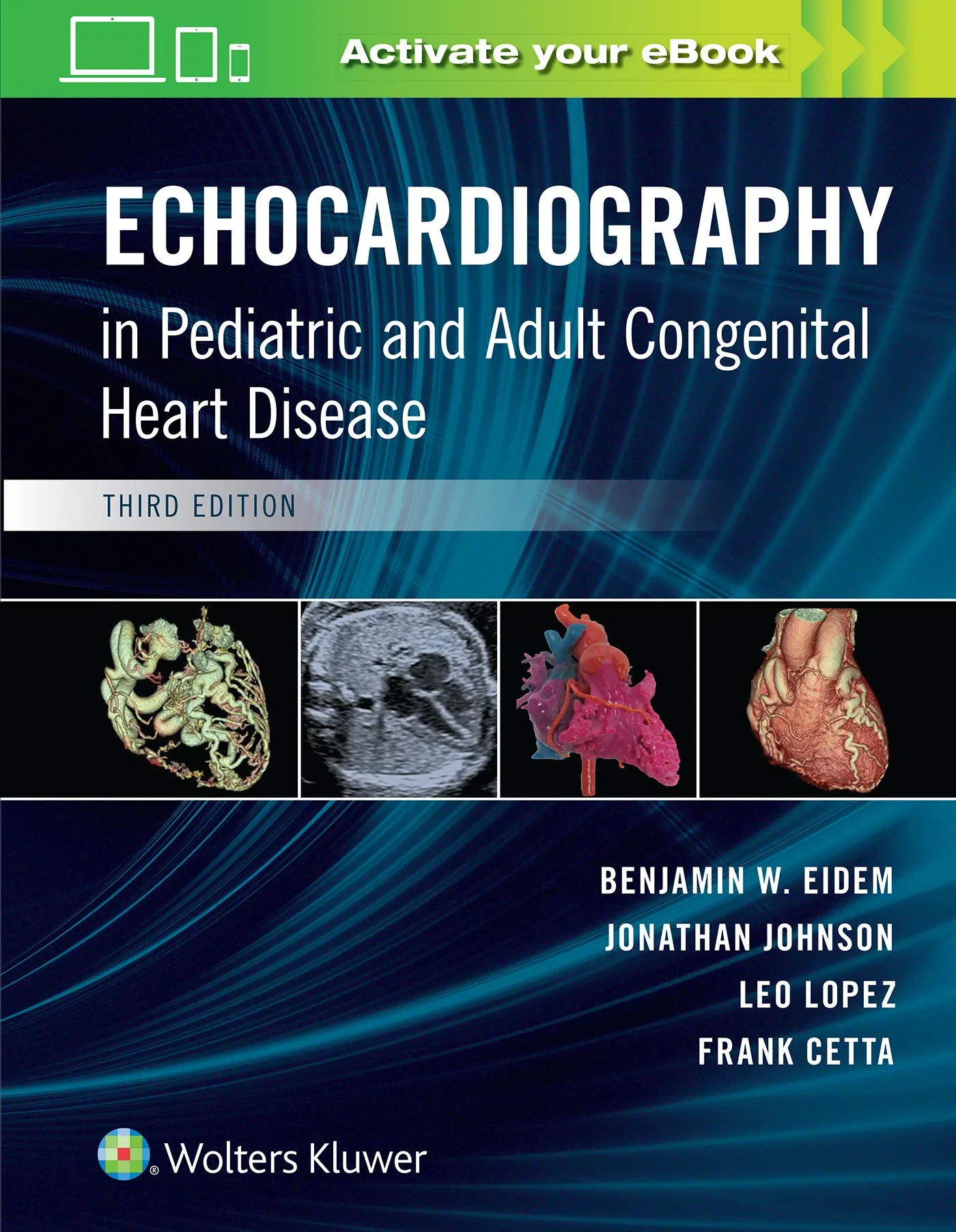 Echocardiography in Pediatric and Adult Congenital...