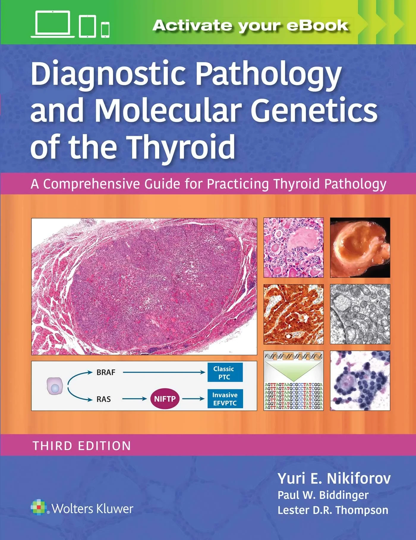 Diagnostic Pathology and Molecular Genetics of the...