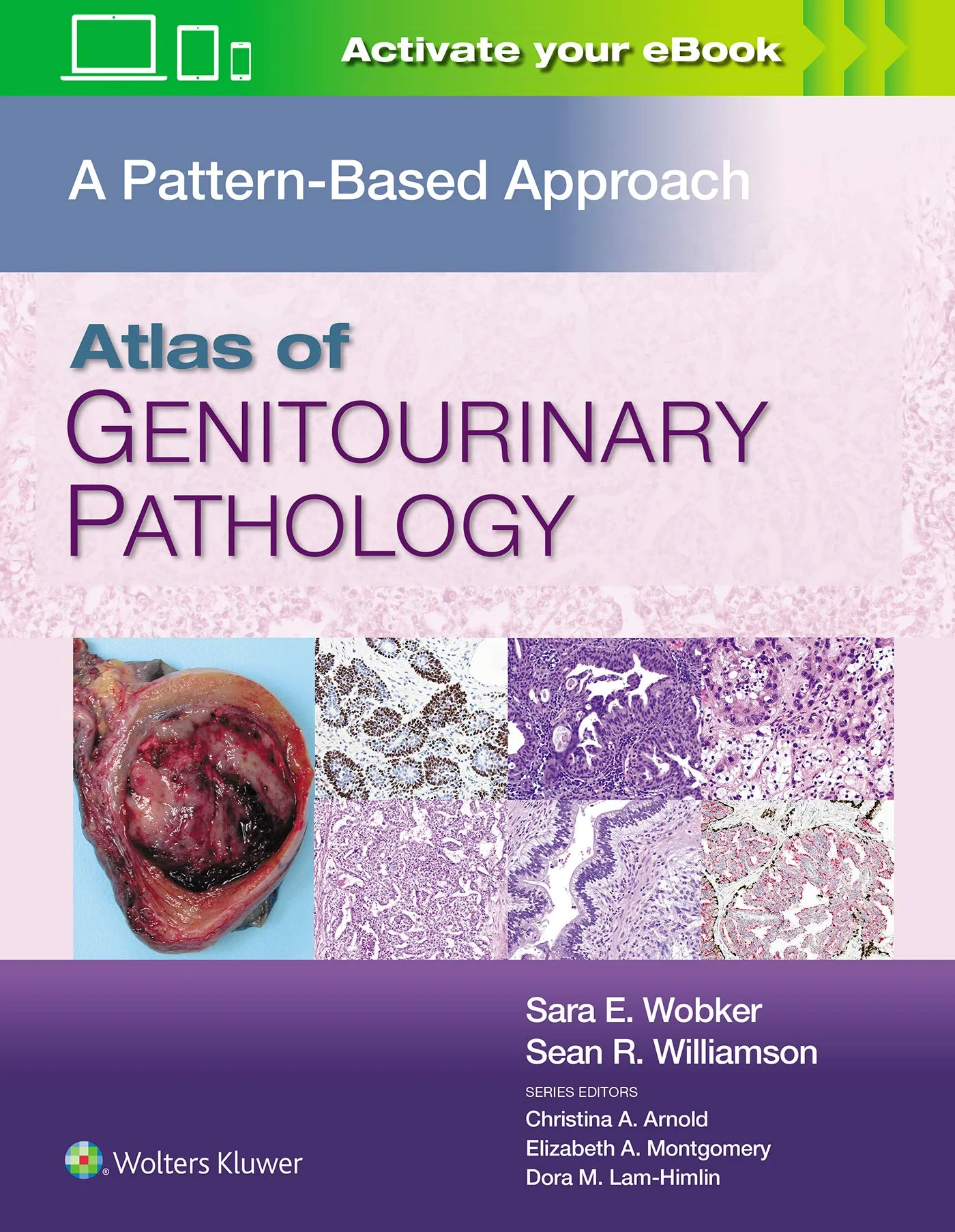 Atlas of Genitourinary Pathology: A Pattern Based ...