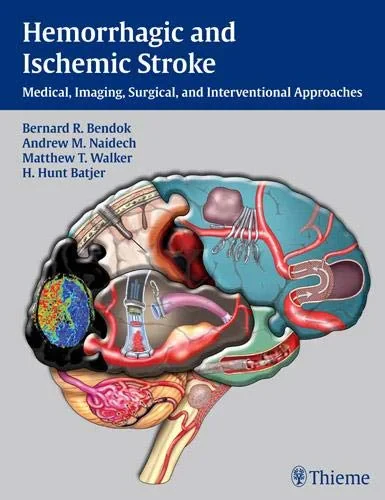 Hemorrhagic and Ischemic Stroke: Medical, Imaging,...