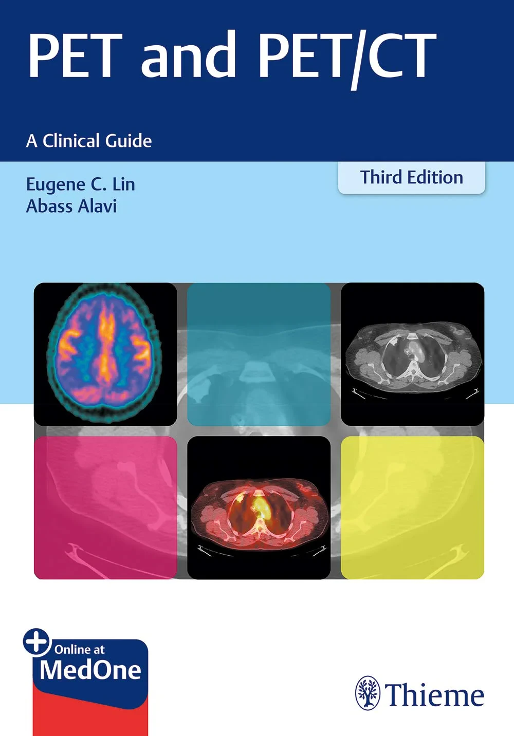 Coperta cărții "PET and PET/CT" de Lin; Alavi, Lin, Alavi