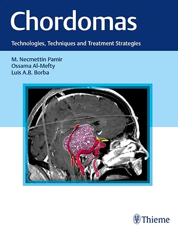 Chordomas: Technologies, Techniques, and Treatment...