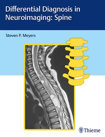 Coperta cărții " Differential Diagnosis in Neuroimaging" de Steven Meyers